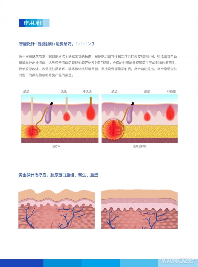 彩页-第4代黄金微针4