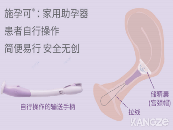 美国施孕可授精辅助系统家用助孕器