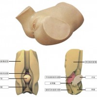 阴道后穹窿穿刺模型