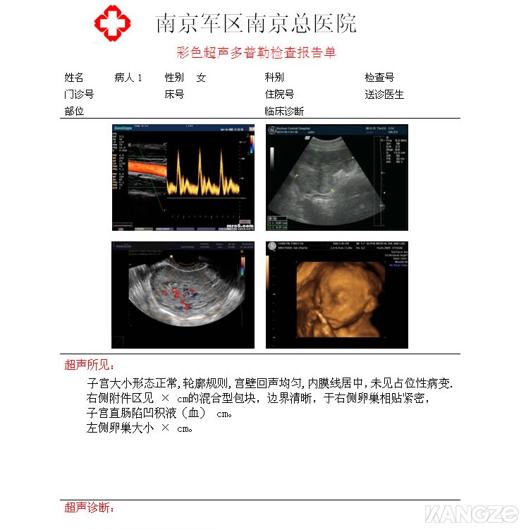 厂家直供医用胶片 超声科 放射科 胶片